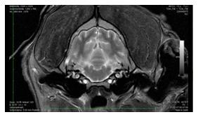 Eine medizinische Aufnahme, die zur Diagnose dient